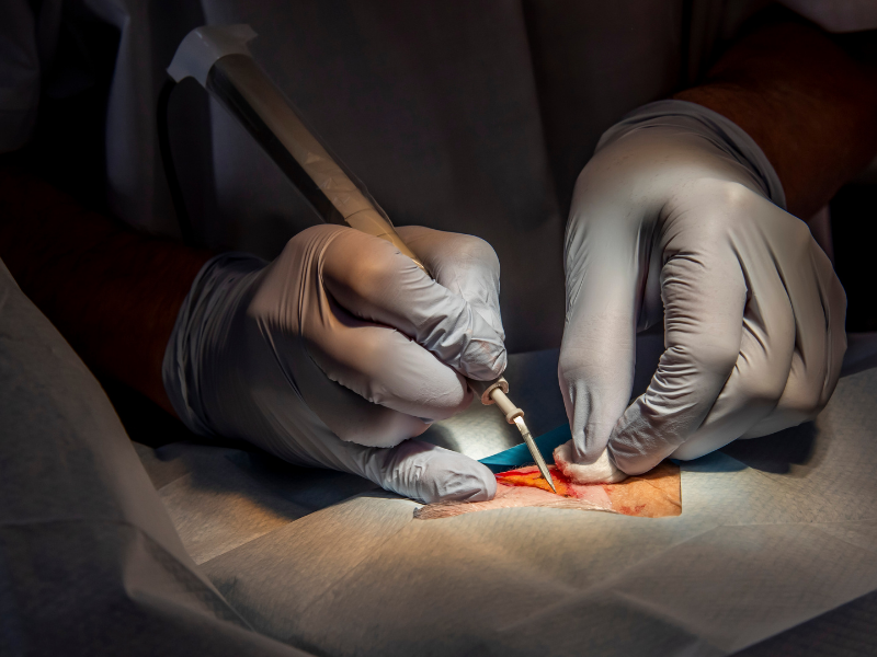 Kapalı ve Açık Ameliyatlar